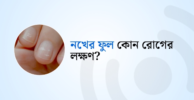 নখের ফুল কোন রোগের লক্ষণ?