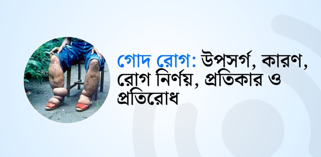 গোদ রোগ : উপসর্গ, কারণ, রোগ নির্ণয়, প্রতিকার ও প্রতিরোধ!